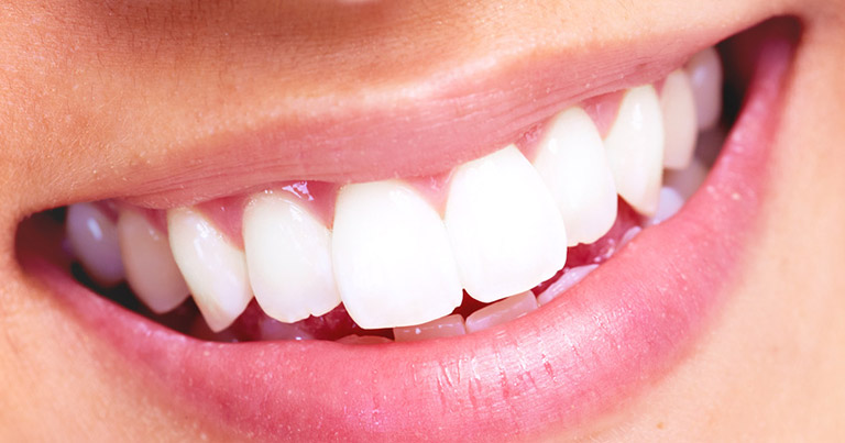 Cuál es el mejor material para coronas dentales