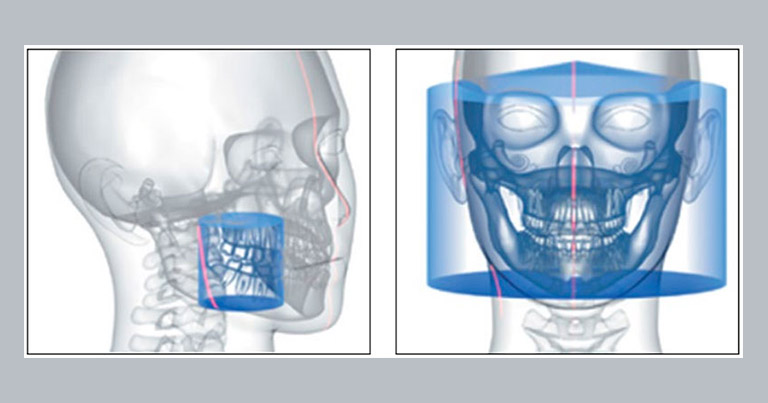 El campo de visión en la radiología dental 3D
