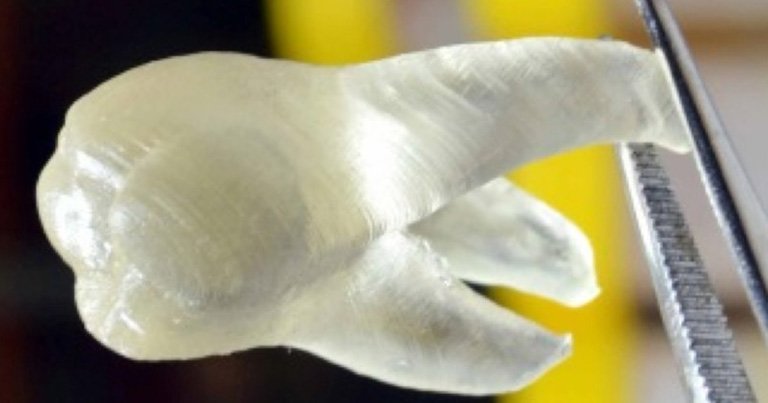 Dientes impresos en 3D, la solución a las caries