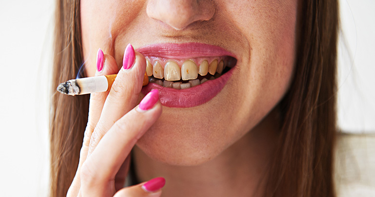 Efectos del tabaco en nuestra salud bucal
