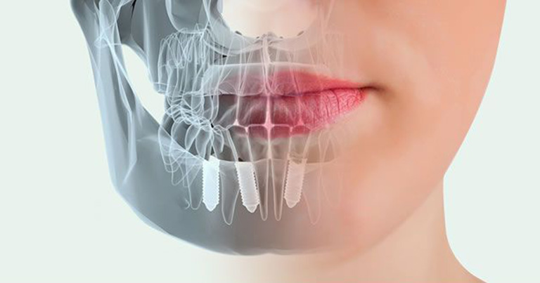 Odontología Digital: un gran avance para la salud bucal 