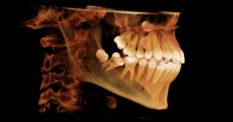 Radiología Dental en 3D