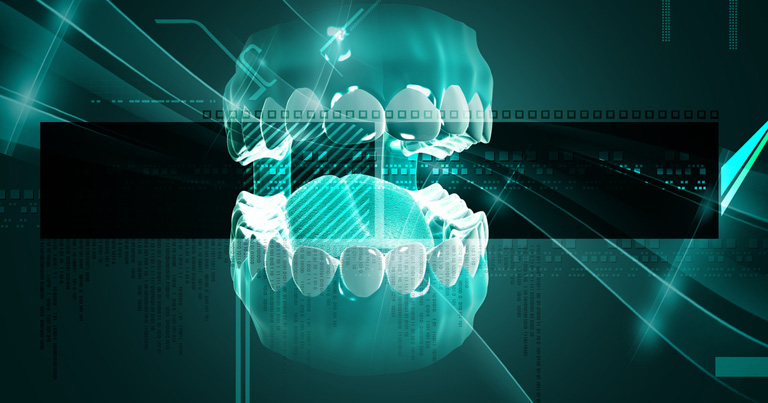Razones para incorporar imágenes 3D en su práctica dental